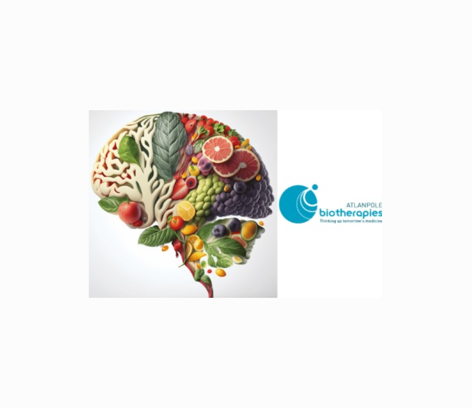 Take advantage of NutrEvent 2024 to preview the place of 